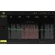 NoiseWorks VoiceAssist Basic